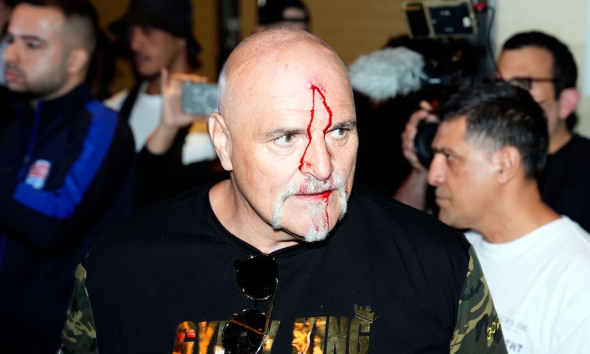 John Fury Apologizes After Bloody Clash with Usyk's Team in Saudi Arabia